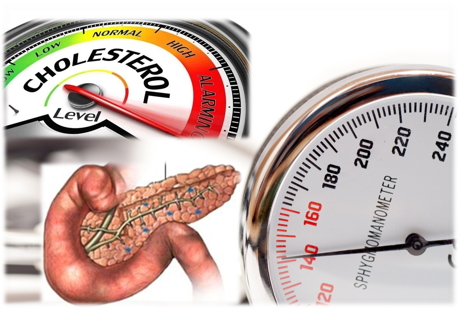 Effective Strategies to Manage the Metabolic Triad: Diabetes, Hypertension, and High Cholesterol